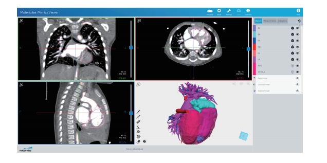 Mimics软件多少钱、正版Mimics软件、正版Mimics软件官网