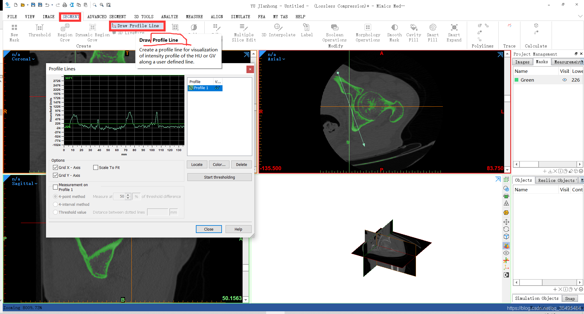 Mimics软件多少钱、正版Mimics软件、正版Mimics软件官网